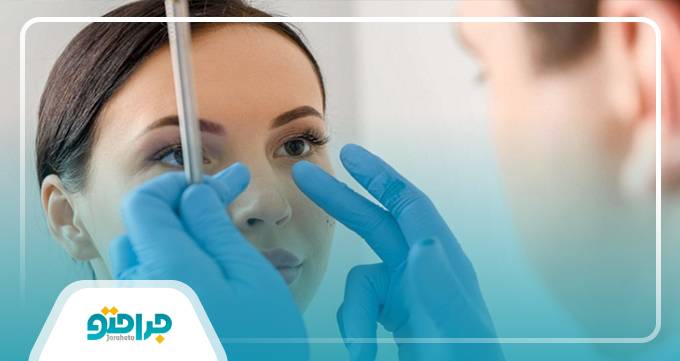مزایا و معایب فیلر بینی از زبان بهترین دکتر اصلاح فرم بینی در تهران