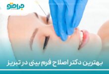 بهترین دکتر اصلاح فرم بینی در تبریز