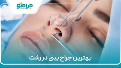 بهترین جراح بینی در رشت