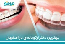 بهترین دکتر ارتودنسی در اصفهان
