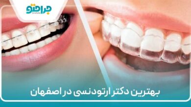 بهترین دکتر ارتودنسی در اصفهان