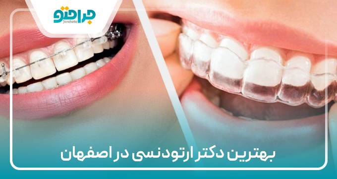 بهترین دکتر ارتودنسی در اصفهان