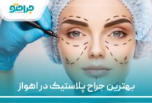 بهترین جراح پلاستیک در اهواز