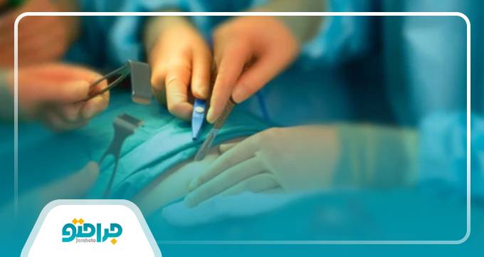 پیکرتراشی چیست؟