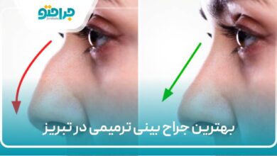 بهترین جراح بینی ترمیمی در تبریز