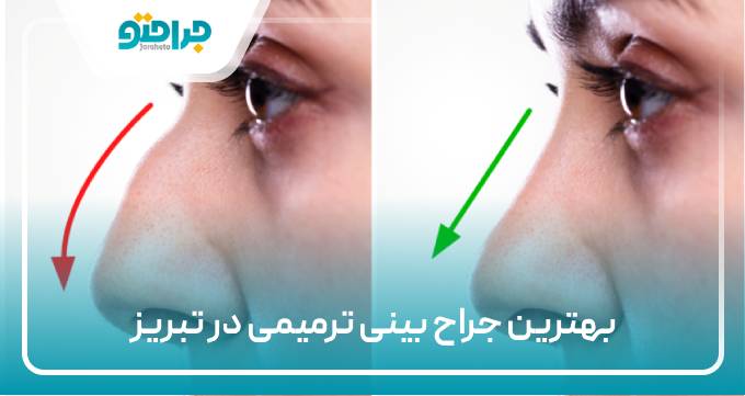 بهترین جراح بینی ترمیمی در تبریز