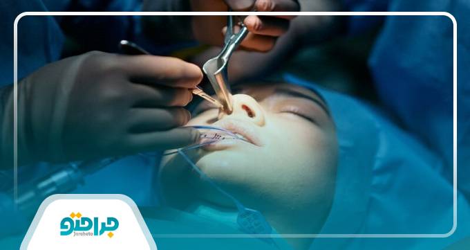 مشاوره و رزرو نوبت از بهترین متخصص جراحی بینی در کرج