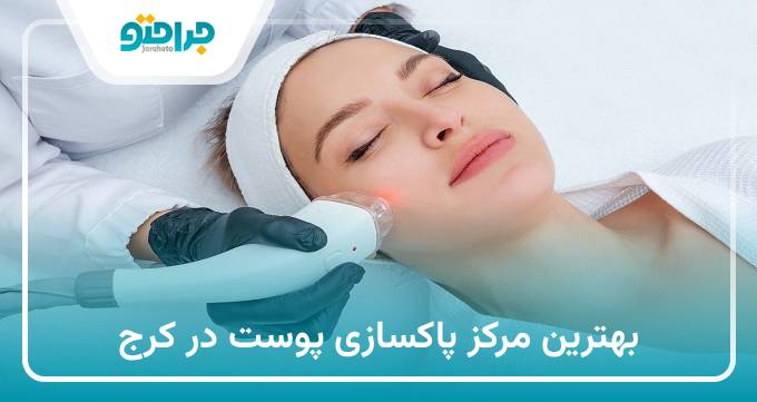 بهترین مرکز پاکسازی پوست در کرج