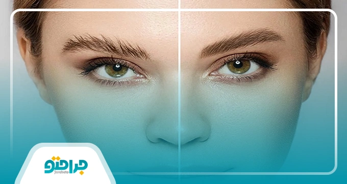 آیا نتایج کاشت ابرو دائمی است؟