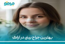 بهترین جراح بینی در اراک