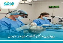 بهترین دکتر کاشت مو در جردن
