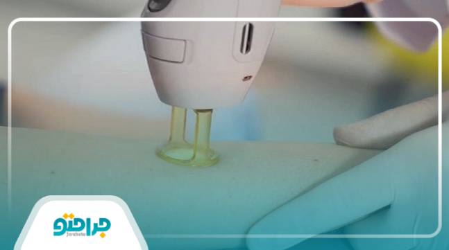 راهنمای نوبت گرفتن از بهترین کلینیک لیزر موهای زائد در مرزداران