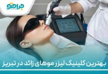 بهترین کلینیک لیزر موهای زائد در تبریز
