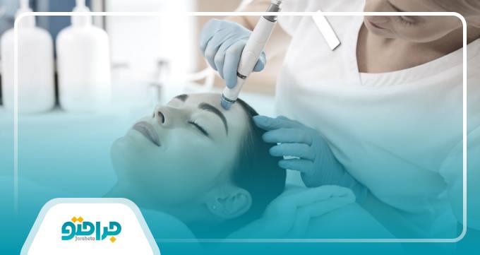 دستگاه های لیزر موهای زائد