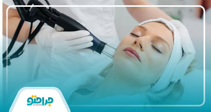 تعداد جلسات مورد نیاز برای لیزر