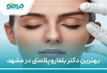 بهترین دتر بلفاروپلاستی در مشهد