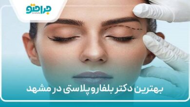 بهترین دتر بلفاروپلاستی در مشهد