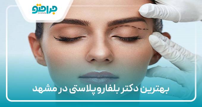 بهترین دتر بلفاروپلاستی در مشهد