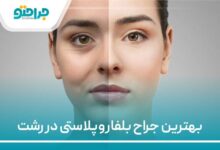 بهترین جراح بلفاروپلاستی در رشت