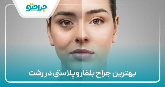 بهترین جراح بلفاروپلاستی در رشت