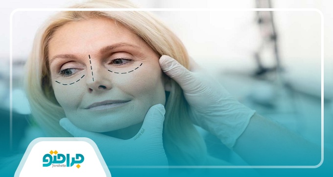 ویژگی های بهترین جراح بلفاروپلاستی در رشت
