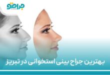 بهترین جراح بینی استخوانی در تبریز