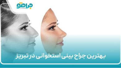 بهترین جراح بینی استخوانی در تبریز