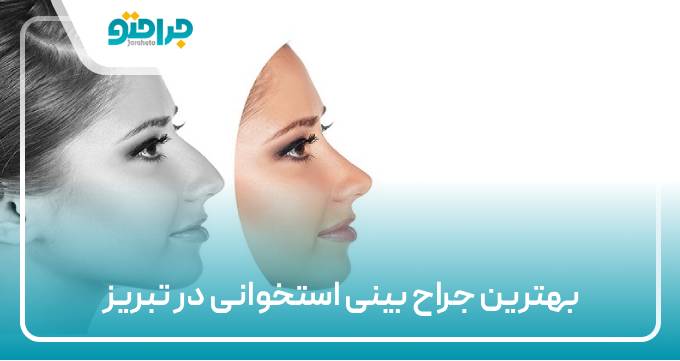 بهترین جراح بینی استخوانی در تبریز