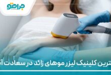بهترین مرکز لیزر در سعادت اباد