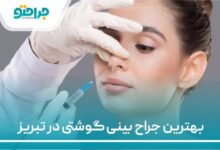 بهترین جراح بینی گوشتی در تبریز