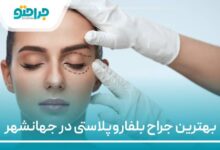 بهترین جراح بلفاروپلاستی در جهانشهر