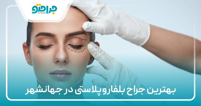 بهترین جراح بلفاروپلاستی در جهانشهر