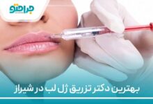 بهترین دکتر تزریق ژل در شیراز