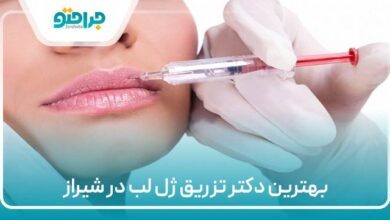 بهترین دکتر تزریق ژل در شیراز