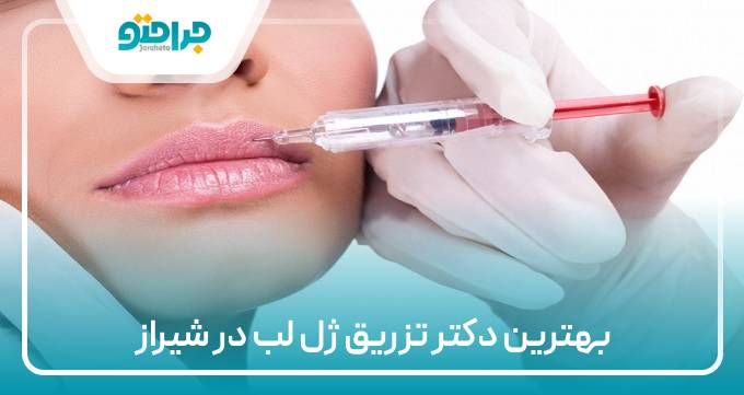 بهترین دکتر تزریق ژل در شیراز