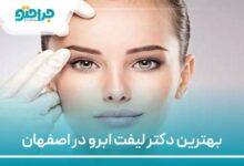 بهترین دکتر لیفت ابرو در اصفهان