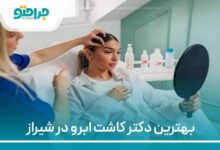 بهترین دکتر کاشت ابرو در شیراز