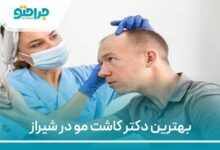 بهترین دکتر کاشت مو در شیراز