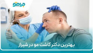 بهترین دکتر کاشت مو در شیراز