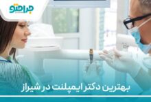 بهترین دکتر ایمپلنت در شیراز