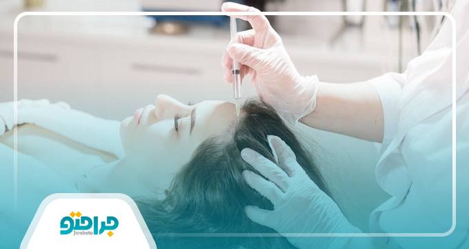 فرآیند مزوتراپی مو