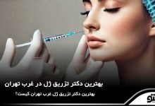 بهترین دکتر تزریق ژل در غرب تهران