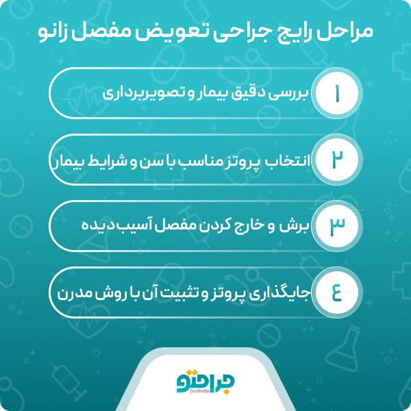 بهترین دکتر تعویض مفصل زانو در تهران چه خصوصیاتی دارد؟