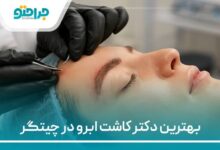 بهترین دکتر کاشت ابرو در تهران