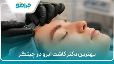 بهترین دکتر کاشت ابرو در تهران