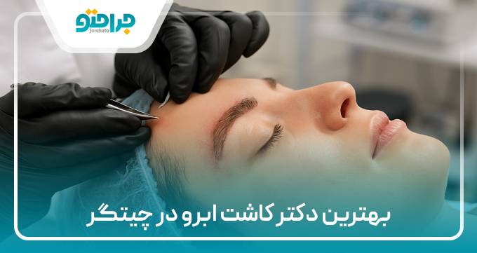 بهترین دکتر کاشت ابرو در تهران
