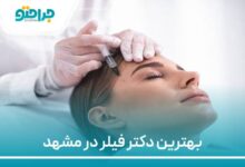 بهترین دکتر فیلر در مشهد