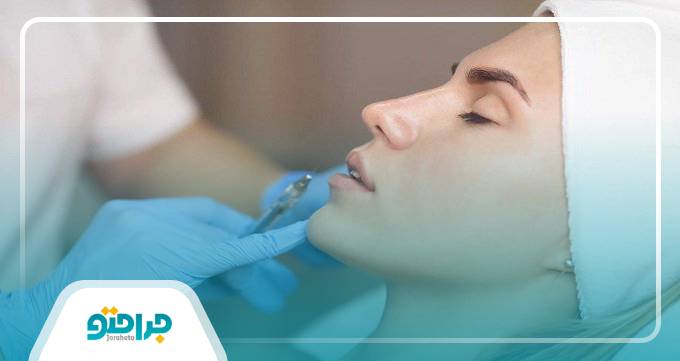 مراقبت‌های قبل و بعد از تزریق فیلر برای داشتن نتیجه طبیعی