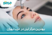 بهترین مرکز لیزر در غرب تهران