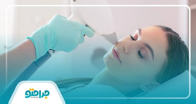 نکات مهم قبل از مراجعه به مرکز لیزر در غرب تهران